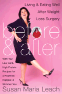 Before & After: Living and Eating Well After Weight-Loss Surgery