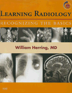 Learning Radiology: Recognizing the Basics