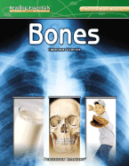 Bones