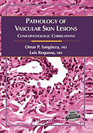 Pathology of Vascular Skin Lesions