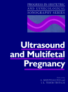 Ultrasound and Multifetal Pregnancy