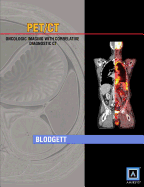 Specialty Imaging: PET/CT: Oncologic Imaging with Correlative Diagnostic CT