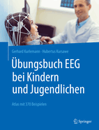 bungsbuch EEG bei Kindern und Jugendlichen: Atlas mit 370 Beispielen