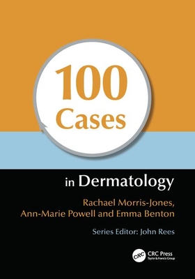 100 Cases in Dermatology - Morris-Jones, Rachael, and Powell, Ann-Marie, and Benton, Emma