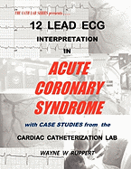 12 Lead ECG Interpretation in Acute Coronary Syndrome with Case Studies from the Cardiac Catheterization Lab