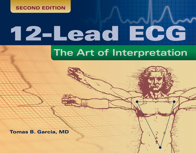 12-Lead ECG: The Art Of Interpretation - Garcia, Tomas B.