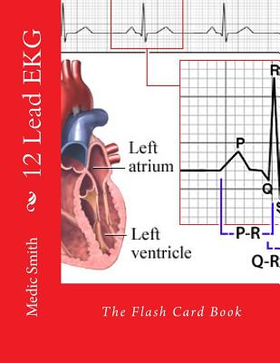 12 Lead EKG: The Flash Card Book - Smith, Medic
