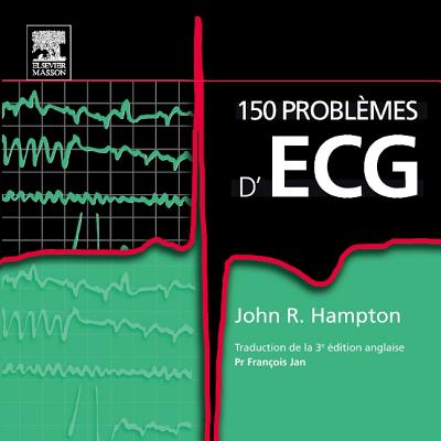 150 Problmes d'Ecg - Hampton, John R, DM, Ma, Dphil, Frcp, and Jan, Francois