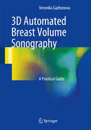 3D Automated Breast Volume Sonography: A Practical Guide