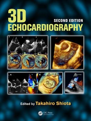 3D Echocardiography - Shiota, Takahiro, MD (Editor)