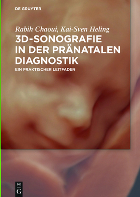 3d-Sonografie in Der Pr?natalen Diagnostik - Chaoui, Rabih, MD, and Heling, Kai-Sven
