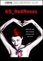 65 Redroses