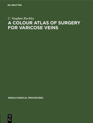 A colour atlas of surgery for varicose veins - Ruckley, C Vaughan