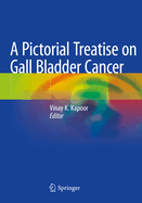 A Pictorial Treatise on Gall Bladder Cancer