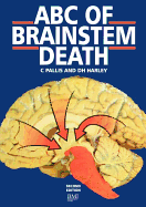 ABC of Brainstem Death