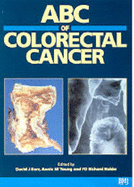 ABC of Colorectal Cancer - Kerr, David J (Editor)