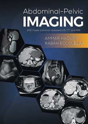 Abdominal-Pelvic Imaging: 200 Cases (Common Diseases): US, CT and MRI - Haouimi, Ammar, and Bouguelaa, Rabah