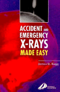 Accident and Emergency X-Rays Made Easy: Accident and Emergency X-Rays Made Easy
