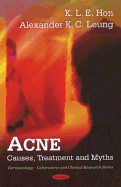 Acne: Causes, Treatment, and Myths