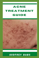 Acne Treatment Guide: Manage acne with ease