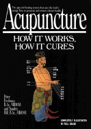 Acupuncture: How It Works, How It Cures