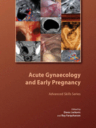 Acute Gynaecology and Early Pregnancy - Jurkovic, Davor (Editor), and Farquharson, Roy (Editor)