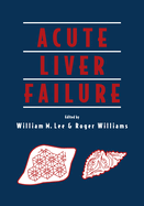 Acute liver failure