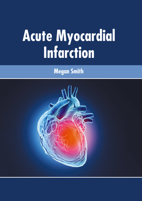 Acute Myocardial Infarction - Smith, Megan (Editor)