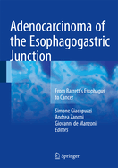 Adenocarcinoma of the Esophagogastric Junction: From Barrett's Esophagus to Cancer