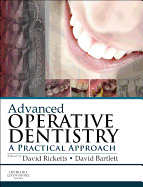 Advanced Operative Dentistry: A Practical Approach