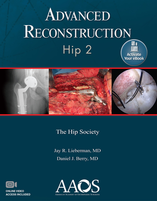 Advanced Reconstruction: Hip 2: Print + eBook with Multimedia - Lieberman, Jay R (Editor), and Berry, Daniel J (Editor)