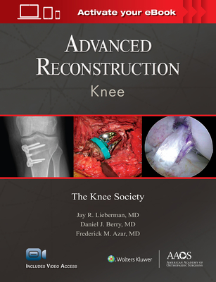 Advanced Reconstruction: Knee: Print + eBook with Multimedia - Lieberman, Jay R (Editor), and Berry, Daniel J (Editor), and Azar, Frederick M, Dr. (Editor)