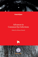 Advances in Common Eye Infections