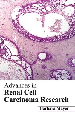Advances in Renal Cell Carcinoma Research - Mayer, Barbara (Editor)