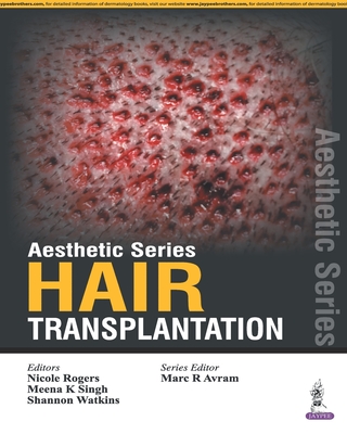 Aesthetic Series - Hair Transplantation - Avram, Marc R (Series edited by), and Rogers, Nicole (Editor), and Singh, Meena K (Editor)