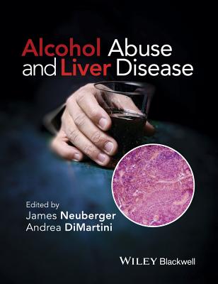 Alcohol Abuse and Liver Disease - Neuberger, James (Editor), and DiMartini, Andrea