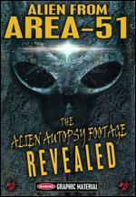 Alien From Area 51: The Alien Autopsy Footage Revealed