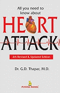 All You Need to Know About Heart Attacks