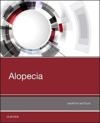 Alopecia - Miteva, Mariya I