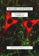 Amyotrophic Lateral Sclerosis