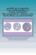 Anlisis de la expresi?n inmunohistoqu?mica en cncer colorrectal: Tipo convencional, serrado y con inestabilidad de microsat?lites