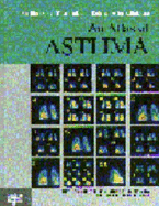 An Atlas of Asthma