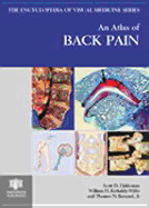 An Atlas of Back Pain