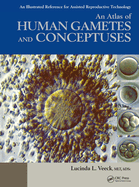 An Atlas of Human Gametes and Conceptuses: An Illustrated Reference for Assisted Reproductive Technology