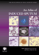 An Atlas of Induced Sputum: An Aid for Research and Diagnosis