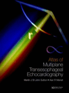 An Atlas of Multiplane Transesophageal Echocardiography