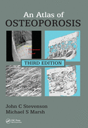 An Atlas of Osteoporosis