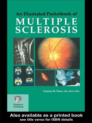 An Illustrated Pocketbook of Multiple Sclerosis - Poser, C M