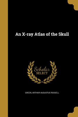 An X-ray Atlas of the Skull - Green, Arthur Augustus Russell (Creator)