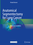 Anatomical Segmentectomy for Lung Cancer: Illustration and Videos